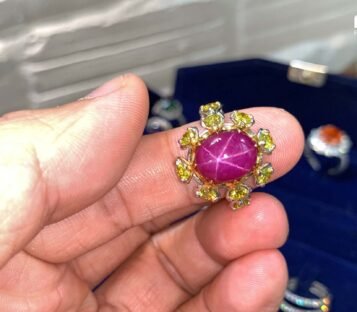 Star Ruby Ring With Yellow Diamonds 2